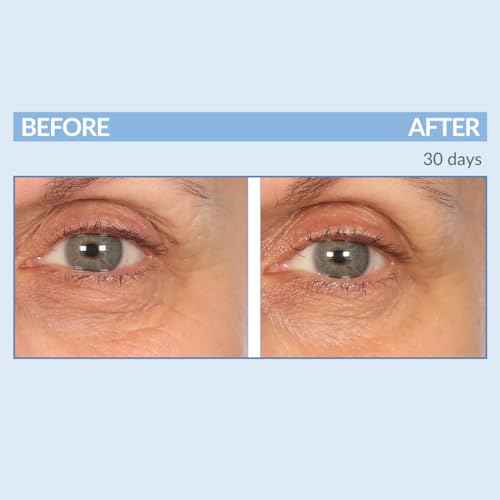 Serious Skincare - Eyetality PM Eye Night Cream with Resveratrol - Keratin & Lash Boosting Peptides for Thicker, Longer Lashes - Antioxidant-Rich to Treat Under Eye Signs of Aging 0.5 FL.Oz.