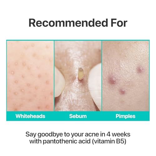 Numbuzin No.1 Pantothenic B5 Soothing Cream – Sebum & Acne Control