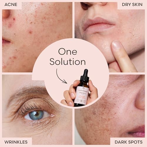 Vitamin C Serum for Face by Outofshell Beauty ? 4-in-1 with Real Retinol, Hyaluronic Acid, Niacinamide ? Brightening, Evens Skin Tone, Lightweight, No Irritation