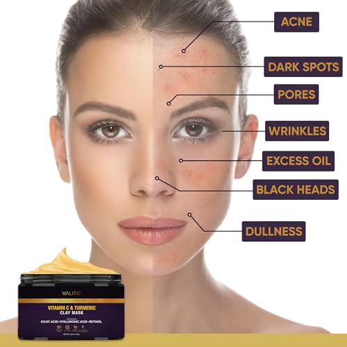 VALITIC 3.52oz Turmeric Vitamin C Clay Mask for Dark Spots & Radiance