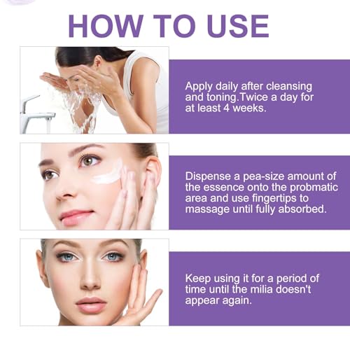 Milia Remover Serum- For Eyes and Face, Milia Remover Treatment for Clear Skin (rose scent))