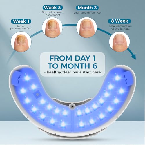 Nail Fungus Laser Treatment Device | Cordless LED Light Portable