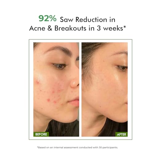 Conscious Chemist¢ç 2% Salicylic Acid Face Wash | 100ml | Face Wash for Oily & Acne Prone Skin for Men & Women, Glycolic Acid & CICA Extract, For Glowing & Radiant Skin, Vegan & Cruelty Free - Flashfix