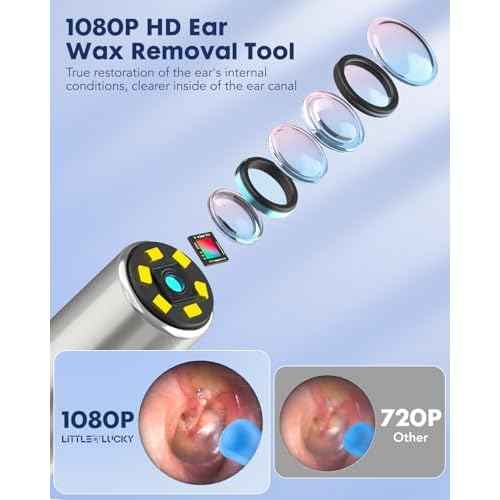 Ear Wax Removal,Littlelucky- 4 in 1 Ear Canal Cleaner 1080P HD Lens with 6 LED Lights for Ear/Nose/Throat/Skin Viewing,Ear Cleaning Kit with 6 Piece Ear Set & 9 Replacement Tips for iOS & Android