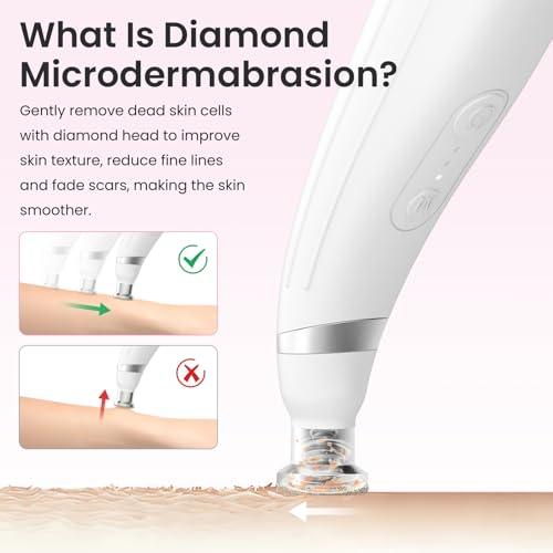 Diamond Microdermabrasion Machine - Blackhead Remover & Pore Vacuum