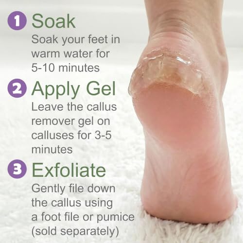 EntreFeet 8 Oz Callus Remover Gel – Extra Strength Foot Callus Remover for Feet (Variation: 8 Oz Callus Remover Gel)