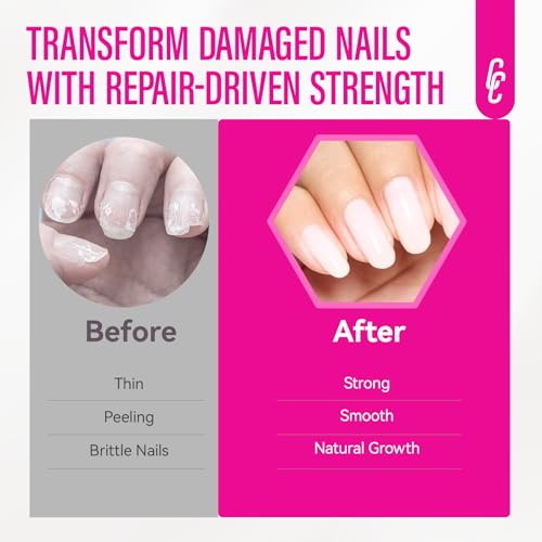 8-in-1 Nail Strengthener & Hardener for Women - 15ml