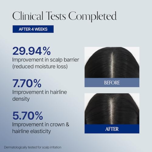 GROWUS Hair Booster Serum with Biotin & Scalp Massager - 14ml