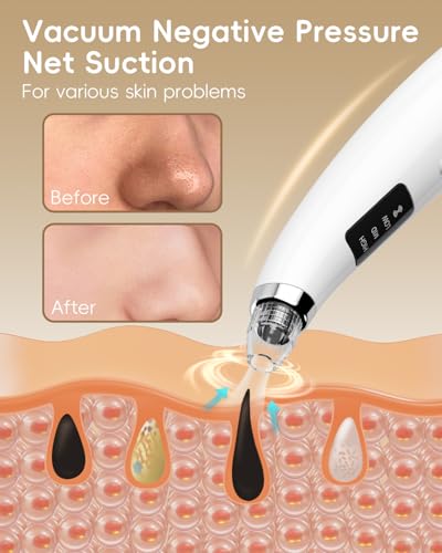 Blackhead Remover Pore Vacuum with 5 Probes & 3 Suction Levels