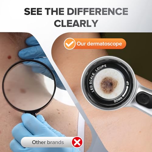 30x Magnifying Dermatoscope with LED - Rechargeable Skin Analyzer