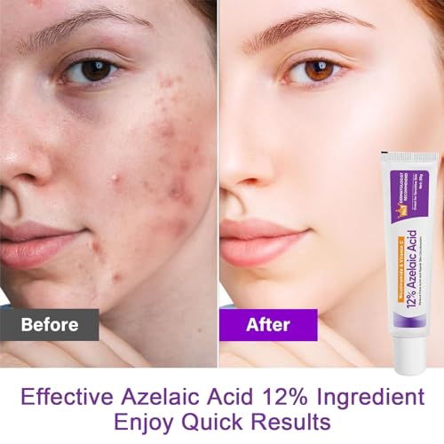 Azelaic Acid Serum, Booster 12% Azelaic Acid Cream, Hyaluronic Acid Serum & Niacinamide for Face, Facial Cream, Balance Excess Sebum,Smoothing Skin and Blemish,Pore Cleansing 1pcs