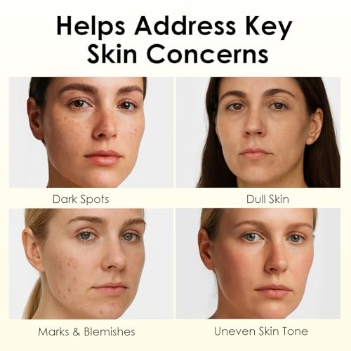 Relief Cream for Skin Barrier Support, Soothing & Nourishing Care for Blemish-Prone and Uneven Skin Tone with Arbutin, Tranexamic Acid & Niacinamide, Vegan Formula for Sensitive Skin, 1.69 fl oz