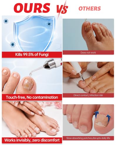 Extra Strength Toenail Fungus Treatment with 1% Tolnaftate - 0.51 fl oz