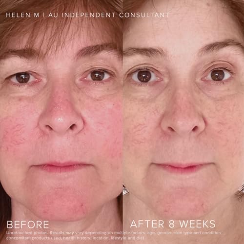 Rodan + Fields Soothe Daily Mineral Sunscreen SPF 30 | 1 Fl Oz | SPF Moisturizer for Face | Zinc Oxide Sunblock | Travel Size Sun Protection Skincare