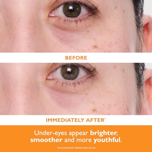 Peter Thomas Roth | Potent-C¢â Power Brightening Hydra-Gel Eye Patches | Eye Mask Patches for Under-Eye Bags and Fine Lines | Brightens The Look of Dark Circles
