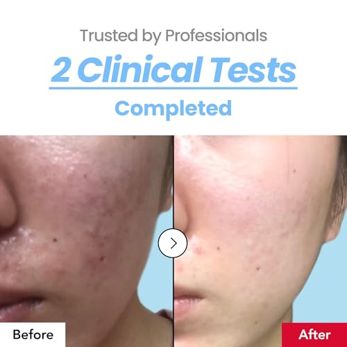 Soothing 10% Toner ? Instant Calming Toner with CICA & Heartleaf, Redness Relief, Cooling & Hydration, Strengthens Skin Barrier for Sensitive, Acne-Prone Skin, Korean Skincare, 10.14 fl oz