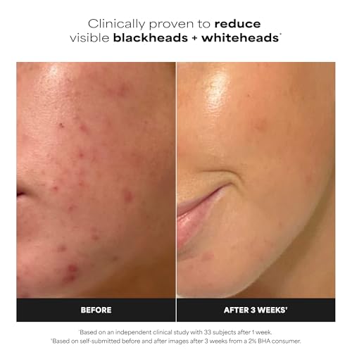 Paula's Choice 2% BHA Exfoliating Pads - Salicylic Acid for Pores