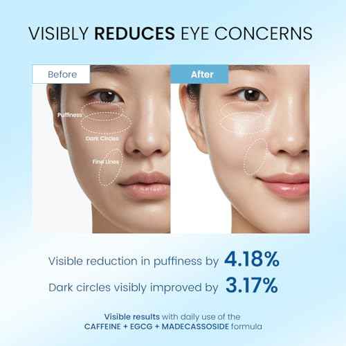 Dongyu Eye Cream for Dark Circles: Korean Caffeine Eye Cream Daily Morning Skincare - Puffy Eyes Treatment for Beauty Enthusiasts (Blue)