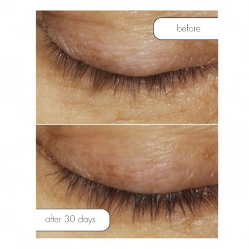 Lash Bath Eye Makeup Remover & Conditioner - 4 oz