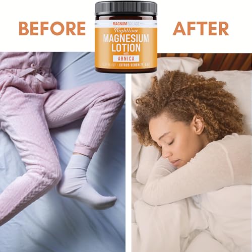 Magnum Solace Nighttime Magnesium Lotion with Arnica ? Soothing Relief & Relaxation, Highly Concentrated Magnesium for Muscles & Joints ? Apply to Legs or Feet Before Bed ? Skin-Friendly