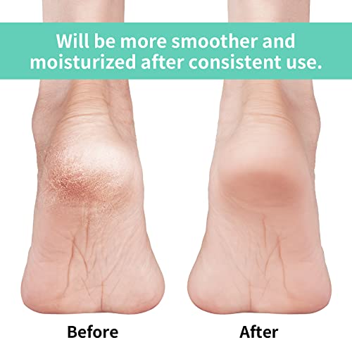 Vaincre Gel Moisturizing Heel Socks for Cracked Feet, 4 Pairs