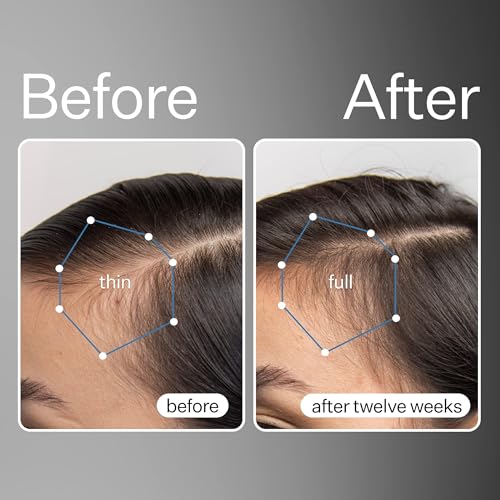 Act+ Acre Stem Cell Scalp Serum for Hair Growth – 1 fl oz