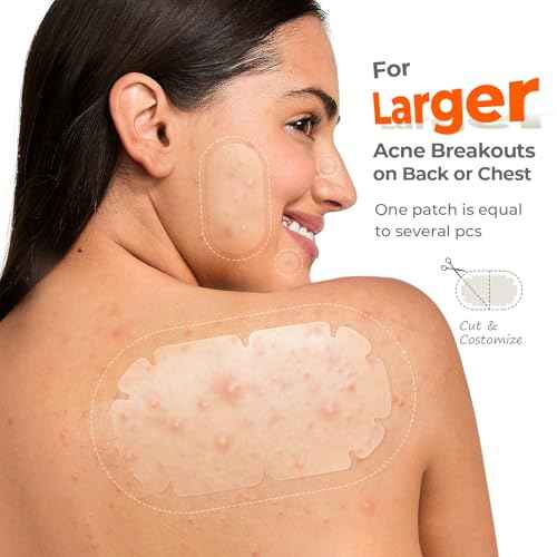 XXL Pimple Patches for Body, Large Hydrocolloid Acne Patches, 5 Sizes Big Hydrocolloid Bandages for Back, Chest, Shoulders Zit Breakouts, Blemish Patch for Face (Oval, Dot 260 Count)