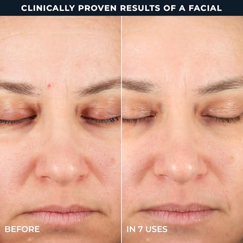 RoC Retinol Correxion 2-Step Peel Pads - 20 Treatments