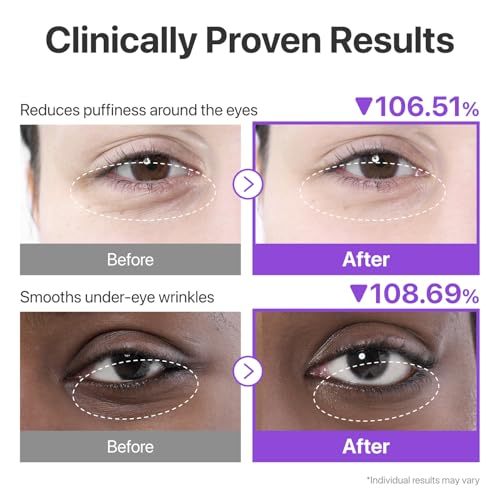 numbuzin No.9 Eye Patches - Cooling Hydrogel for Puffiness & Hydration