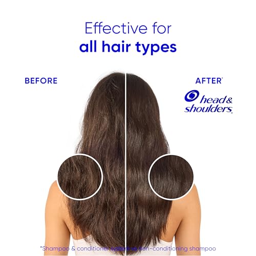 Head & Shoulders Smooth & Silky Anti-Dandruff 2-in-1 Shampoo, 28.2 Fl Oz