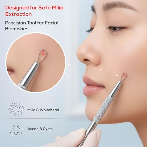 Suvorna Pimple Popper Tool Kit, 4-Piece Blackhead & Milia Remover