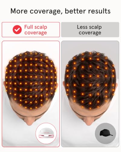 iRestore Laser Hair Growth Cap - FDA-Cleared Therapy for Thinning Hair