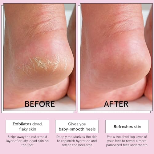 Grace & Stella Exfoliating Foot Peel Mask for Dry Cracked Feet - 4 Pairs