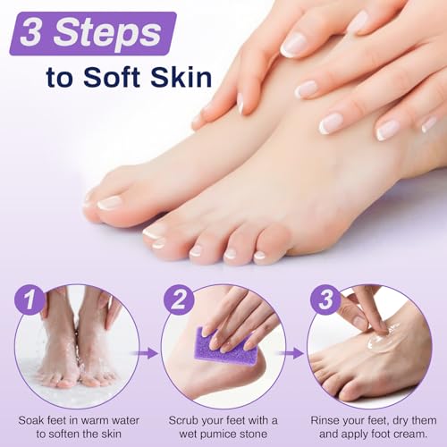 20 Pack Small Pumice Stones for Feet - Exfoliating Foot Callus Remover