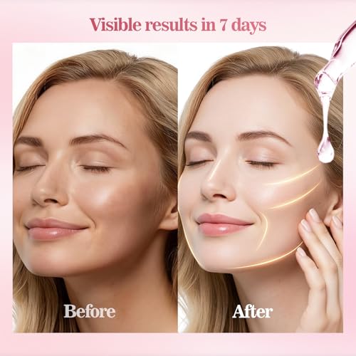 Salmon DNA Rejuvenating Serum ? 5000ppm PDRN + 2000ppm Marine Collagen, Glutathione, Niacinamide & 6x Hyaluronic Complex ? Korean Anti-Aging Ampoule for Radiance & Fine Lines ? 30 x 0.04 fl.oz