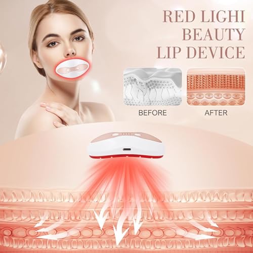 TsoLay Electric Lip Plumper with Suction Control & Timer