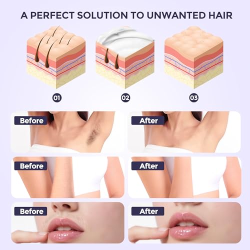 Hair Removal Cream for Women, Plant-Based Sensitive Skin Formula, Fast-Acting Depilatory Cream for Legs/Arms/Underarms/Stomach/Bikini Line, 2-in-1 Hair Removal ((3.38 Fl Oz (Pack of 1)))