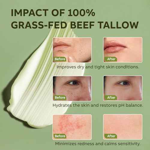 Beef Tallow for Skin, Beef Tallow and Honey Balm, All-Natural Face Body Moisturizer Nourishes and Hydrates the Skin, Grass Fed Whipped Balm Infused with Raw Wild Honey 2oz