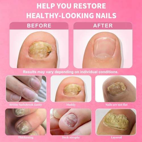 60 Pcs Nail Care Patches - Hydrating Overnight Repair for Healthy Nails