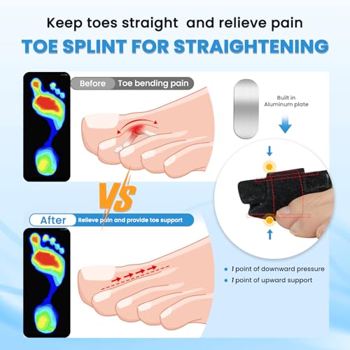 Hammer Toe Straightener Splint Corrector - 2 Pack