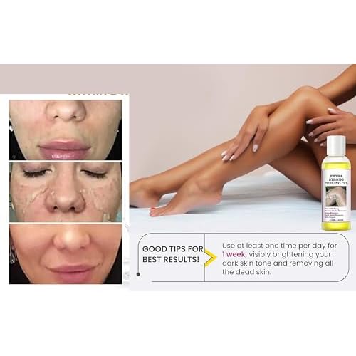 Yellow Peeling Oil - 330ML/10.98Fl Oz, Chemical Peel for Dark Skin, Exfoliating Body Oil for All Skin Types