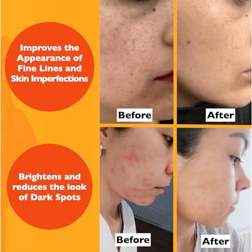 Vitamin C Serum For Face ? Anti Aging Face Serum with Vitamin C, Hyaluronic Acid, Vitamin E. Brightening Formula. Improve Appearance of Dark Spots, Tone, Fine Lines & Wrinkles, Glowing Skin 2 Fl Oz