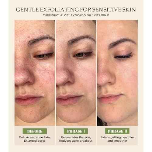 Vitamin C and Turmeric Face Scrub, Face Scrub for All Skin Types -Physical Scrub to Exfoliate Face & Body, Anti Aging Facial Exfoliating Scrub, Clears Blackheads Improve Dark Spots 4.23 Oz