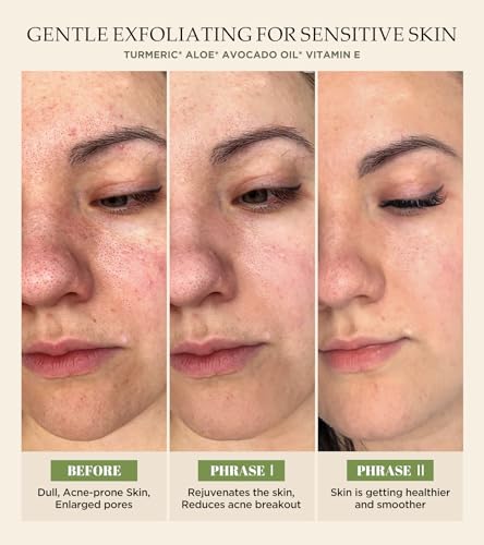 Vitamin C & Turmeric Face Scrub - Gentle Exfoliating Cleanser, 4.23 oz