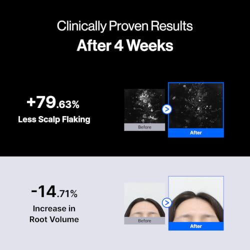 Refilled cADPR Hair Growth Serum for Thin Hair & Scalp Care
