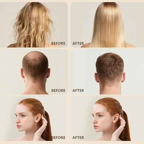 100% Natural Raw Batana Oil for Hair Growth, Unrefined & Organic Dr Sebi Hair Growth Oil From Honduras, Prevents Hair Loss, Eliminates Split Ends, Enhances Thickness 4.23 Fl Oz (Pack of 1)