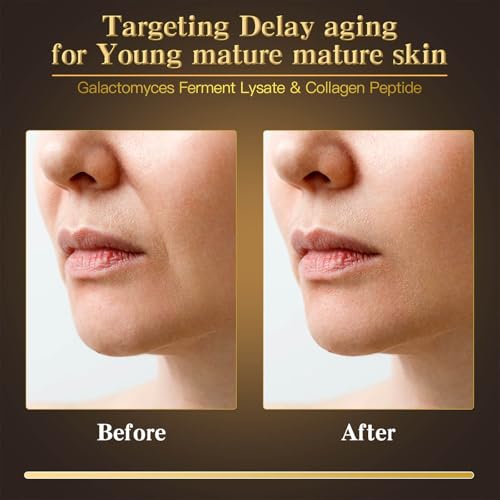 24K Gold & Caviar Collagen Face Mask, 5 Pack ? Luxurious Hydrating Facial Treatment, Firming Appearance ? Supports a Radiant, Rejuvenated Look Overnight