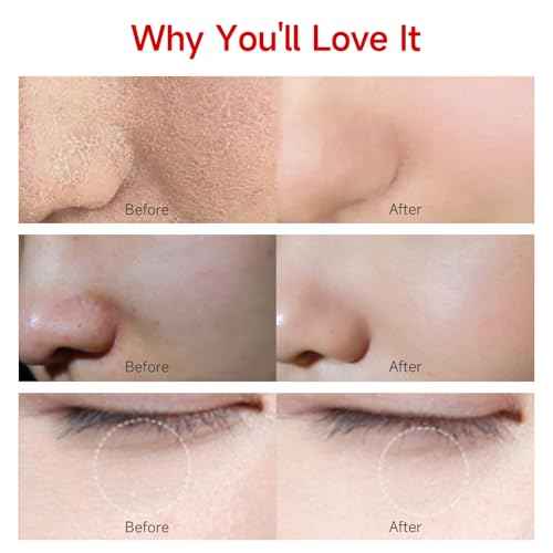 Rejuvenating Zero Pore Toner Cotton Pads with Hyaluronic Acid & MC-PDRN - Moisturizing Facial Korean Skin Care for Smooth Skin£¨100 Pads£©