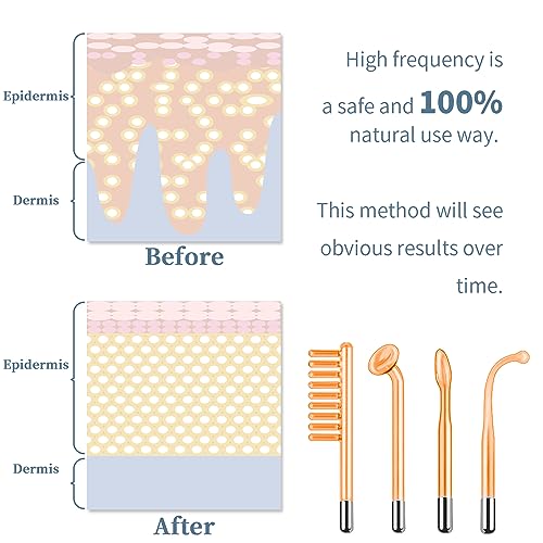 TUMAKOU High Frequency Facial Machine with 4 Glass Tubes