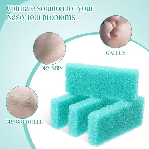Pumice Stone Bulk 300 Pack - Foot Scrubber Callus Remover for Feet (Cyan)
